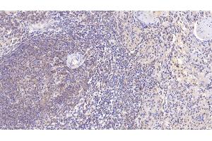 Detection of SOD3 in Human Spleen Tissue using Monoclonal Antibody to Superoxide Dismutase 3, Extracellular (SOD3) (SOD3 anticorps  (AA 19-240))