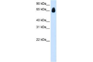 WB Suggested Anti-TRIM32 Antibody Titration:  1. (TRIM32 anticorps  (C-Term))
