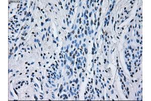 Immunohistochemical staining of paraffin-embedded Kidney tissue using anti-RNF144Bmouse monoclonal antibody. (RNF144B anticorps  (AA 1-256))