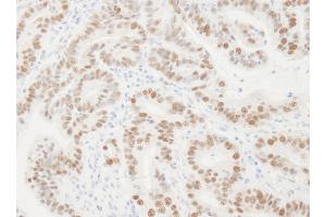 Immunohistochemistry (IHC) image for anti-Proliferating Cell Nuclear Antigen (PCNA) (AA 75-125) antibody (ABIN7454604) (PCNA anticorps  (AA 75-125))