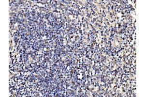 IHC analysis of Kinectin 1/KTN1 using anti-Kinectin 1/KTN1 antibody (ABIN7601096). (KTN1 anticorps  (AA 283-827))