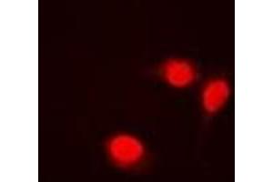 Immunofluorescent analysis of Transketolase staining in Jurkat cells. (TKT anticorps)