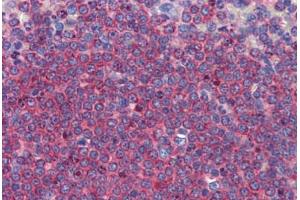 Human Spleen: Formalin-Fixed, Paraffin-Embedded (FFPE) (ALDH5A1 anticorps  (C-Term))