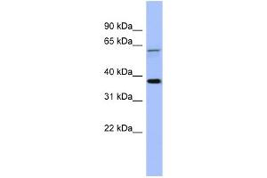 WB Suggested Anti-MAGEB1 Antibody Titration: 0. (MAGEB1 anticorps  (Middle Region))