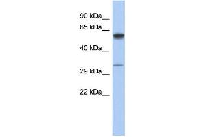 WB Suggested Anti-ZDHHC24 Antibody Titration: 0. (ZDHHC24 anticorps  (Middle Region))
