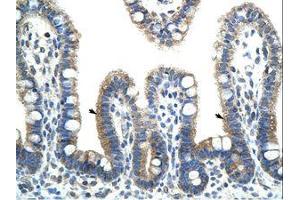 Image no. 1 for anti-BTB (POZ) Domain Containing 6 (BTBD6) (AA 87-136) antibody (ABIN202456) (BTBD6 anticorps  (AA 87-136))