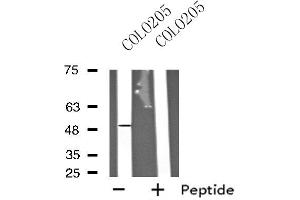 Western blot analysis of extracts from COLO205 cells, using HRH3 antibody. (HRH3 anticorps  (Internal Region))