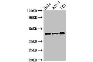Western Blot Positive WB detected in: Hela whole cell lysate, MCF-7 whole cell lysate, PC-3 whole cell lysate All lanes: PRKAR2A antibody at 2.