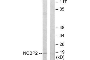 Western blot analysis of extracts from COLO205 cells, using NCBP2 antibody. (NCBP2 anticorps  (N-Term))