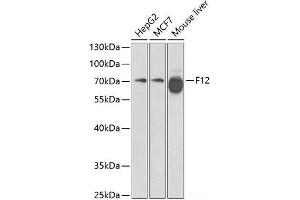 Western blot analysis of extracts of various cell lines using F12 Polyclonal Antibody at dilution of 1:1000. (F12 anticorps)