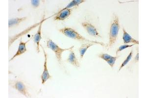 IHC testing of FFPE human HeLa cells with ERAB antibody.