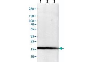 Western blot analysis of cell lysates with NME1-NME2 polyclonal antibody  at 1:100-1:500 dilution. (NME1 anticorps)