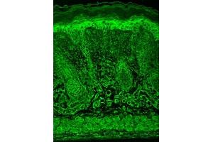 Immunohistochemistry analysis using Mouse Anti-HIF1 alpha Monoclonal Antibody, Clone ESEE122 (ABIN863096 and ABIN863097).