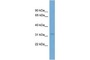 WB Suggested Anti-KRCC1  Antibody Titration: 0. (KRCC1 anticorps  (N-Term))