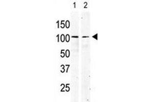 cKit antibody used in western blot to detect KIT in serum-starved HeLa cell lysate (lane 1) and primate testis tissue lysate (2). (KIT anticorps  (AA 9-40))