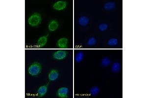 ABIN570878 Immunofluorescence analysis of paraformaldehyde fixed L929 cells (Mouse fibroblast cell line), permeabilized with 0.