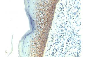 Formalin-fixed, paraffin-embedded human Skin stained with E-Cadherin Monoclonal Antibody (SPM381).