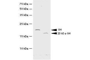 Recombinant hGH and 20kDa hGH were resolved by electrophoresis, transferred to PVDF membrane and probed with anti-hGH(1:500). (Growth Hormone 1 anticorps  (AA 27-217))
