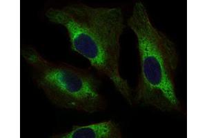 Immunocytochemistry (ICC) image for anti-Signal Transducer and Activator of Transcription 5A (STAT5A) (AA 583-794) antibody (ABIN1845625) (STAT5A anticorps  (AA 583-794))