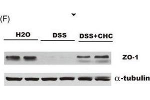 Administration of CHC ameliorates DSS-induced colitis in mice. (TJP1 anticorps  (AA 1600-1700))