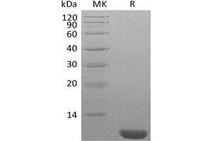 Western Blotting (WB) image for Neural Precursor Cell Expressed, Developmentally Down-Regulated 8 (NEDD8) protein (ABIN7319921) (NEDD8 Protéine)