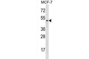 Western Blotting (WB) image for anti-Ladinin 1 (LAD1) antibody (ABIN2996996) (Ladinin 1 anticorps)