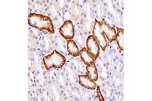 Immunohistochemistry of paraffin embedded mouse kidney using SLC7A8 (ABIN7074503) at dilution of 1:1100 (400x lens)