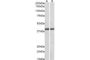 ABIN2562862 (0. (GNAQ anticorps  (AA 162-175))