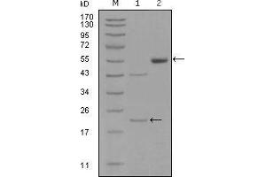 Western blot analysis using EPHA5 mouse mAb against truncated EPHA5-His recombinant protein (1) and truncated EPHA5(aa620-774)-hIgGFc transfected CHO-K1 cell lysate(2). (EPH Receptor A5 anticorps  (AA 620-774))