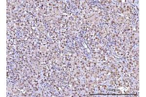 IHC analysis of RFX1 using anti-RFX1 antibody (ABIN7601842).
