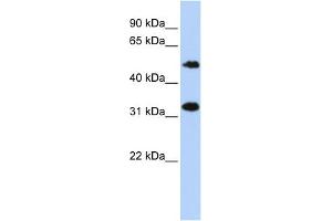 WB Suggested Anti-C6orf150 Antibody Titration: 0. (C6orf150 anticorps  (Middle Region))
