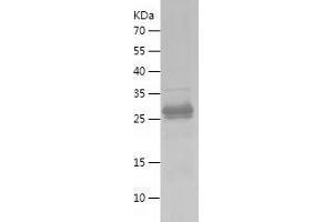 Western Blotting (WB) image for Hepcidin Antimicrobial Peptide (HAMP) (AA 24-84) protein (His-IF2DI Tag) (ABIN7123314)