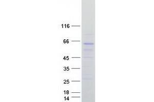 Validation with Western Blot