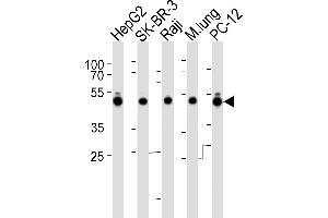 Western blot analysis of lysates from HepG2, SK-BR-3, Raji cell line, mouse lung tissue lysate and rat PC-12 cell line (from left to right), using DNAJA1 Antibody (C-term) (ABIN6242850 and ABIN6577522).