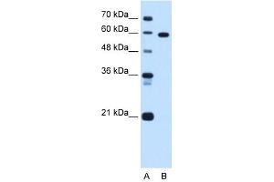 Western Blot showing TBX15 antibody used at a concentration of 1. (T-Box 15 anticorps  (C-Term))