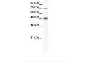 Image no. 1 for anti-DEAD (Asp-Glu-Ala-Asp) Box Polypeptide 50 (DDX50) (N-Term) antibody (ABIN202889) (DDX50 anticorps  (N-Term))