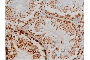 ABIN6267398 at 1/200 staining Mouse testis tissue sections by IHC-P. (H2AFX anticorps  (pSer139))