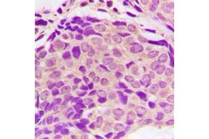 anti-SH2 Domain Containing 4A (SH2D4A) (Center) antibody
