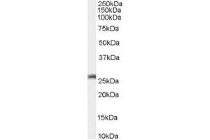 Image no. 1 for anti-Gap Junction Protein, beta 2, 26kDa (GJB2) (C-Term) antibody (ABIN374836) (GJB2 anticorps  (C-Term))