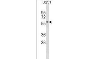 Rab9p40 Antibody (C-term) (ABIN1537097 and ABIN2838354) western blot analysis in  cell line lysates (35 μg/lane). (RABEPK anticorps  (C-Term))