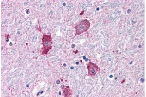 Anti-NPY5R antibody  ABIN1049126 IHC staining of human brain, neurons and glia. (NPY5R anticorps  (Cytoplasmic Domain))