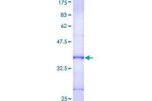 Image no. 1 for Dyskeratosis Congenita 1, Dyskerin (DKC1) (AA 321-420) protein (GST tag) (ABIN1351642)