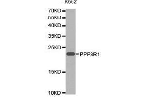 Western Blotting (WB) image for anti-Protein Phosphatase 3, Regulatory Subunit B, alpha (PPP3R1) antibody (ABIN1874237) (PPP3R1 anticorps)