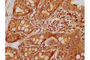 IHC image of ABIN7146053 diluted at 1:400 and staining in paraffin-embedded human small intestine tissue performed on a Leica BondTM system.