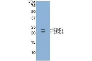 Detection of Recombinant EDN1, Mouse using Polyclonal Antibody to Endothelin 1 (EDN1)