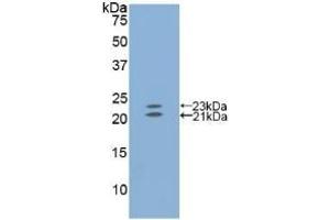 Detection of Recombinant EDN1, Mouse using Polyclonal Antibody to Endothelin 1 (EDN1) (Endothelin 1 anticorps  (AA 33-202))