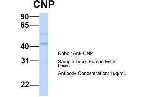 Host:  Rabbit  Target Name:  CNP  Sample Type:  Human Fetal Heart  Antibody Dilution:  1.