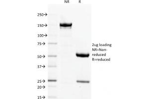 SDS-PAGE Analysis Purified Filaggrin Mouse Monoclonal Antibody (FLG/1563). (Filaggrin anticorps  (AA 998-1104))