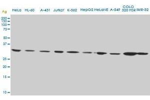 CD5L monoclonal antibody (M01), clone 1C8.
