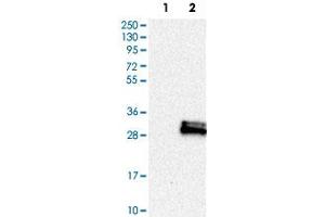 Western Blot analysis of Lane 1: negative control (vector only transfected HEK293T cell lysate) and Lane 2: over-expression lysate (co-expressed with a C-terminal myc-DDK tag in mammalian HEK293T cells) with PAEP polyclonal antibody . (PAEP anticorps)